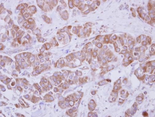 TIP30 Antibody in Immunohistochemistry (Paraffin) (IHC (P))