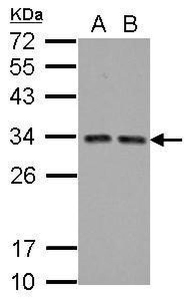 TIP30 Antibody in Western Blot (WB)