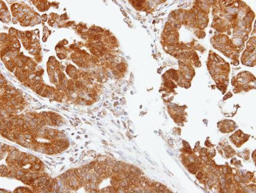 TDP1 Antibody in Immunohistochemistry (Paraffin) (IHC (P))