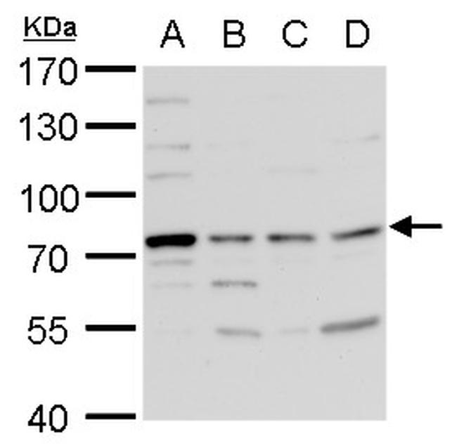 TDP1 Antibody in Western Blot (WB)