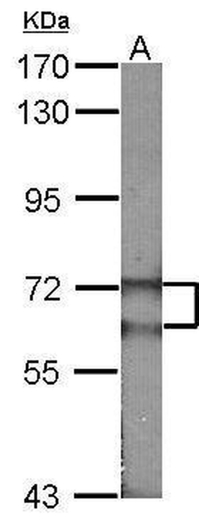 FANCG Antibody in Western Blot (WB)