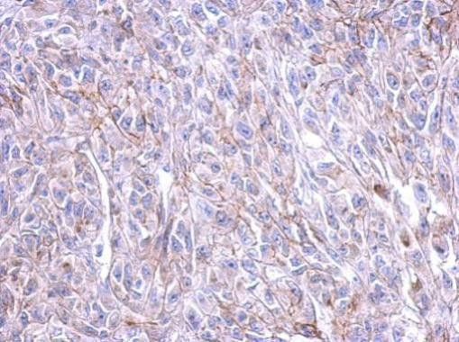 CRHR1 Antibody in Immunohistochemistry (Paraffin) (IHC (P))