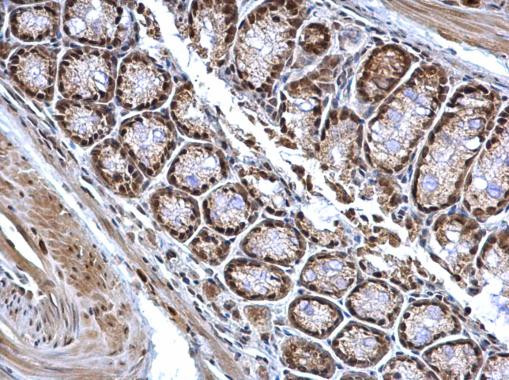 BCL7A Antibody in Immunohistochemistry (Paraffin) (IHC (P))