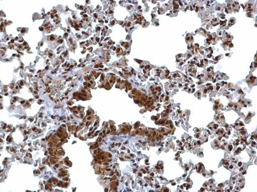 BCL7A Antibody in Immunohistochemistry (Paraffin) (IHC (P))