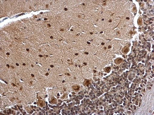 BCL7A Antibody in Immunohistochemistry (Paraffin) (IHC (P))