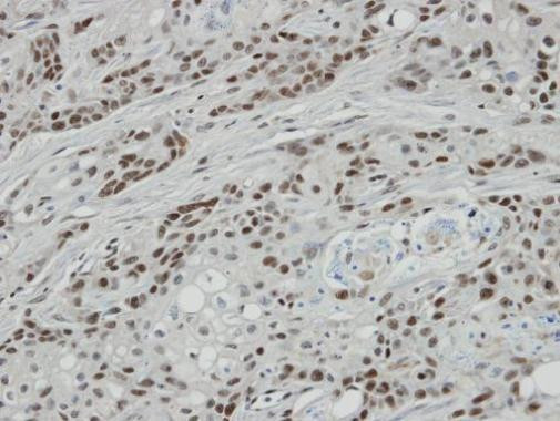 BCL7A Antibody in Immunohistochemistry (Paraffin) (IHC (P))