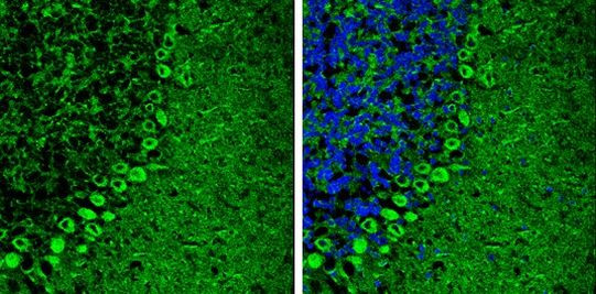 Calcium Channel beta-4 Antibody in Immunohistochemistry (Frozen) (IHC (F))