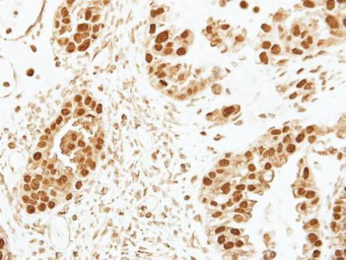 CENPF Antibody in Immunohistochemistry (Paraffin) (IHC (P))