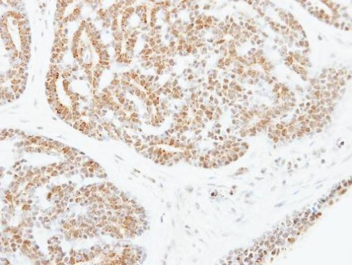 ATF2 Antibody in Immunohistochemistry (Paraffin) (IHC (P))