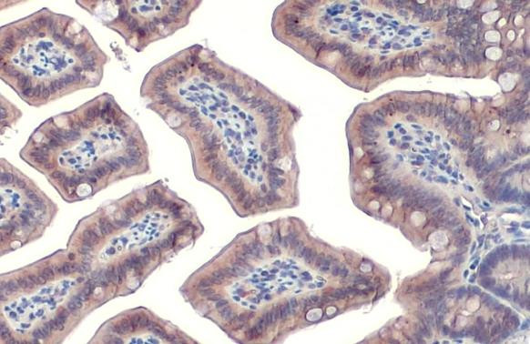 Cortactin Antibody in Immunohistochemistry (Paraffin) (IHC (P))