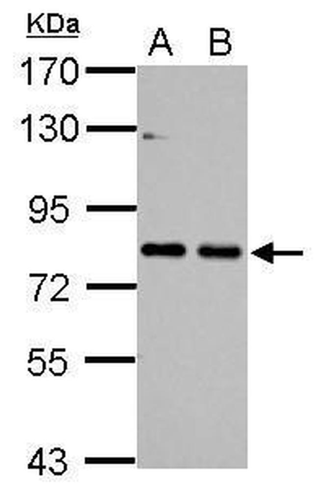 Cortactin Antibody in Western Blot (WB)