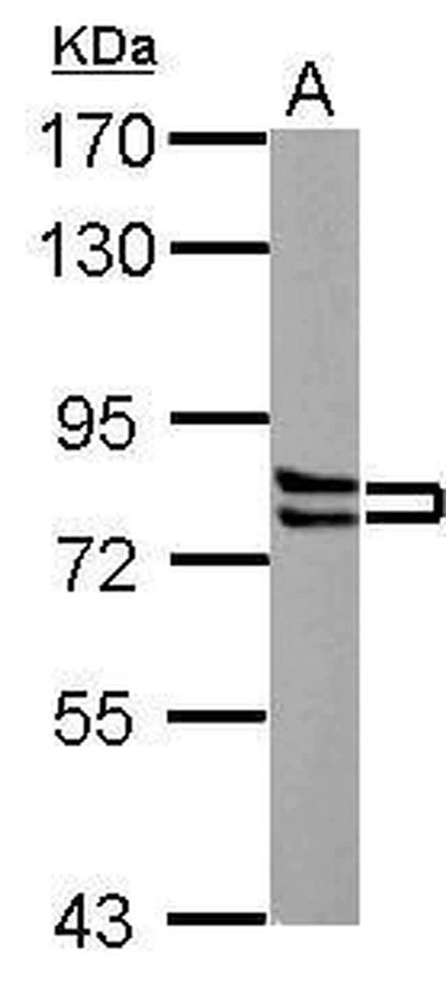 Cortactin Antibody in Western Blot (WB)