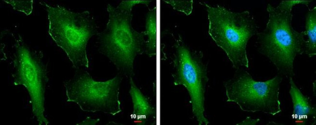 Cortactin Antibody in Immunocytochemistry (ICC/IF)