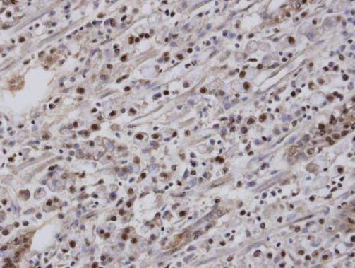 EAR2 Antibody in Immunohistochemistry (Paraffin) (IHC (P))