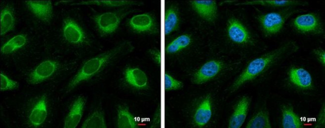 ACSL4 Antibody in Immunocytochemistry (ICC/IF)