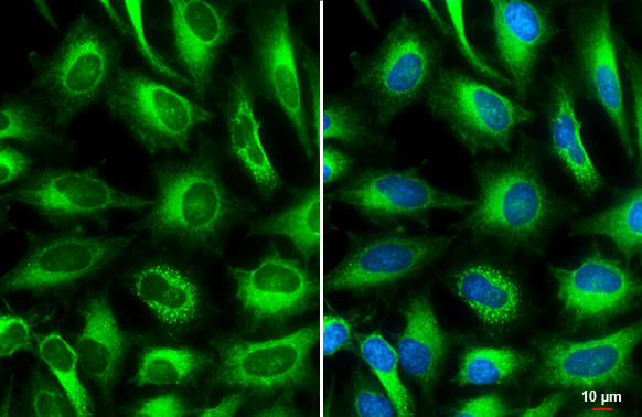 ACSL4 Antibody in Immunocytochemistry (ICC/IF)