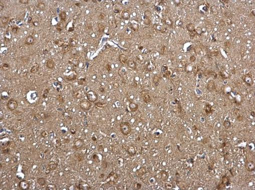 ACSL4 Antibody in Immunohistochemistry (Paraffin) (IHC (P))