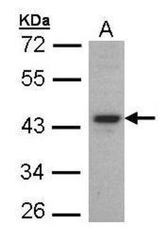 FOXE1 Antibody in Western Blot (WB)