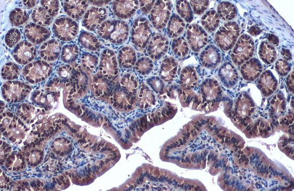 FOXO3A Antibody in Immunohistochemistry (Paraffin) (IHC (P))