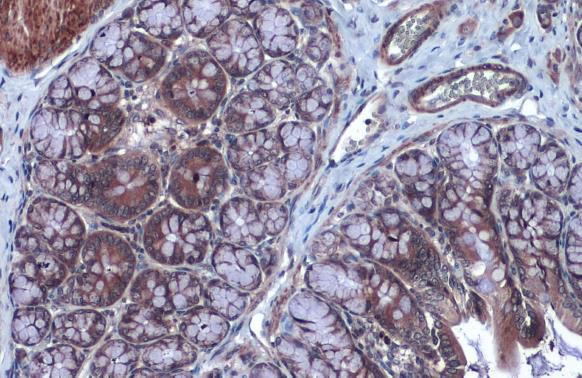 FOXO3A Antibody in Immunohistochemistry (Paraffin) (IHC (P))