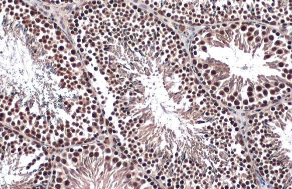 FOXO3A Antibody in Immunohistochemistry (Paraffin) (IHC (P))