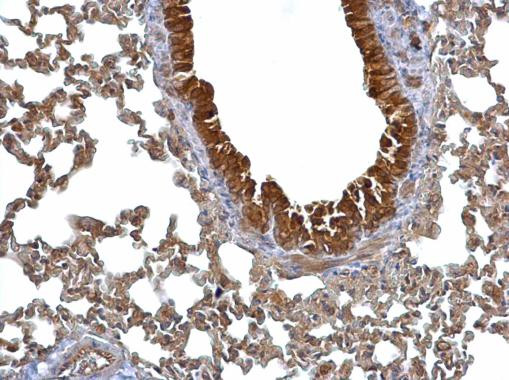 14-3-3 sigma Antibody in Immunohistochemistry (Paraffin) (IHC (P))