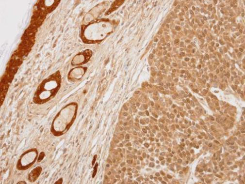 14-3-3 sigma Antibody in Immunohistochemistry (Paraffin) (IHC (P))