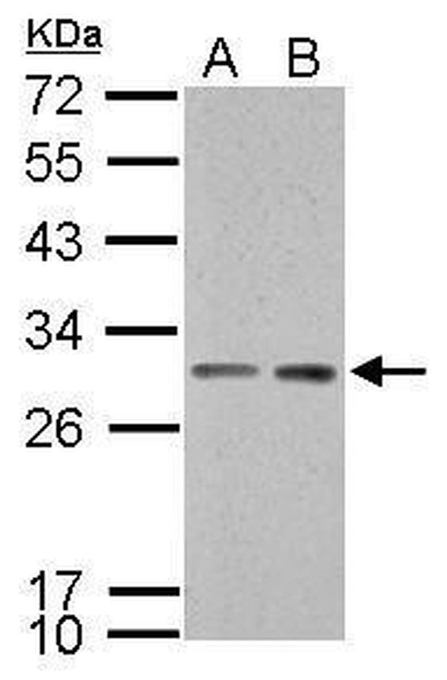 14-3-3 sigma Antibody in Western Blot (WB)