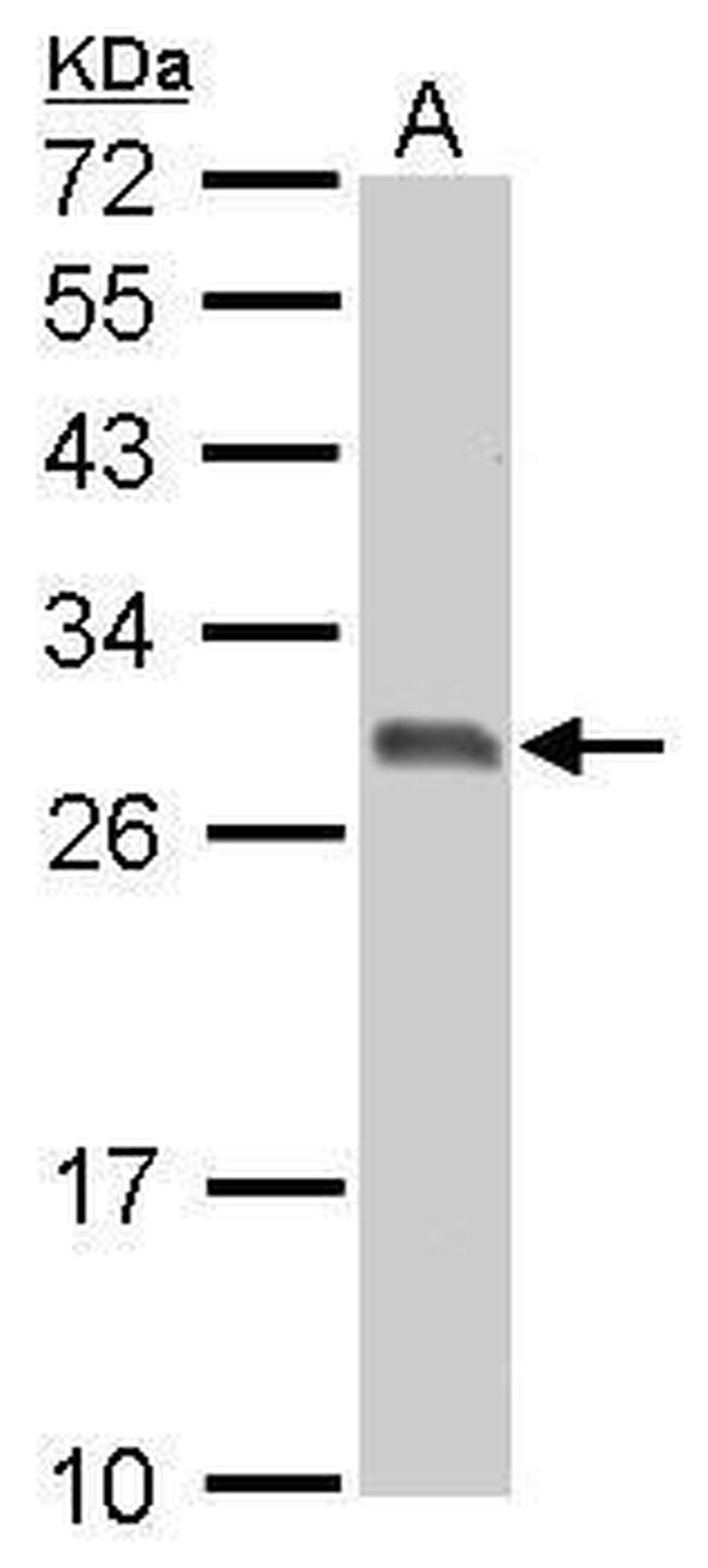 14-3-3 sigma Antibody in Western Blot (WB)