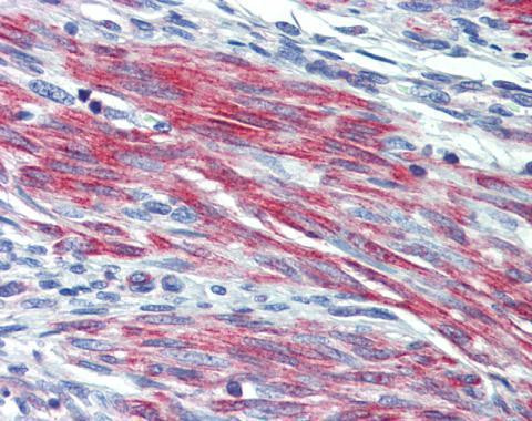 GPR40 Antibody in Immunohistochemistry (Paraffin) (IHC (P))