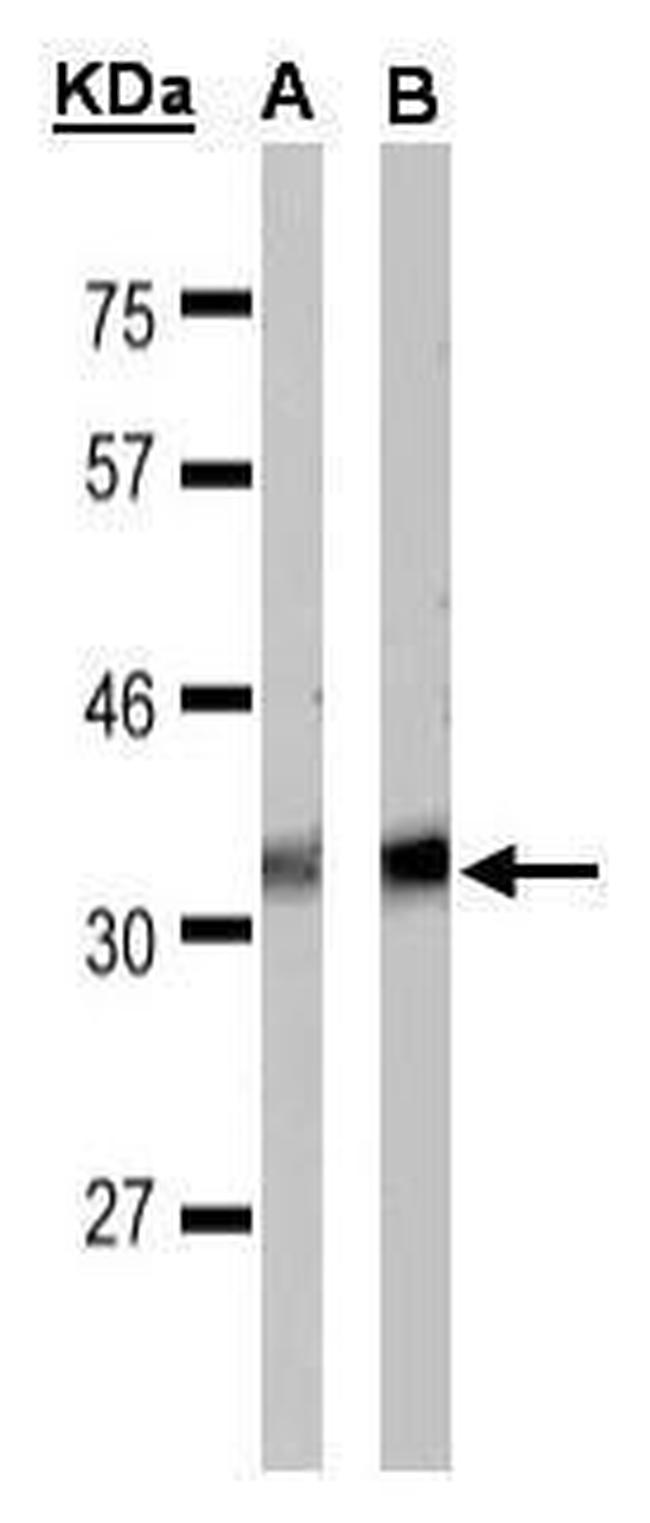 GPR40 Antibody in Western Blot (WB)