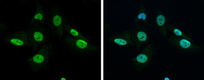 GRB2 Antibody in Immunocytochemistry (ICC/IF)