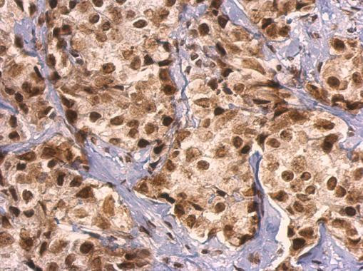 GRB2 Antibody in Immunohistochemistry (Paraffin) (IHC (P))