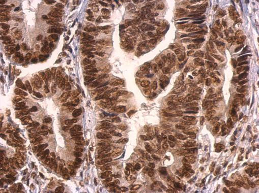 GRB2 Antibody in Immunohistochemistry (Paraffin) (IHC (P))