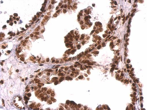 GRB2 Antibody in Immunohistochemistry (Paraffin) (IHC (P))