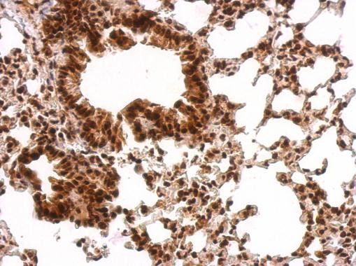 GRB2 Antibody in Immunohistochemistry (Paraffin) (IHC (P))