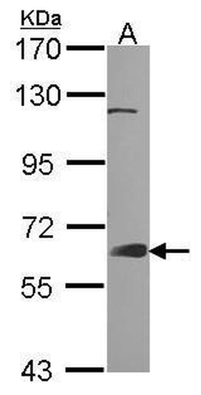 GRB7 Antibody in Western Blot (WB)