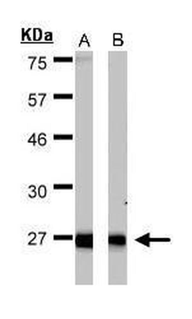 ERAB Antibody in Western Blot (WB)