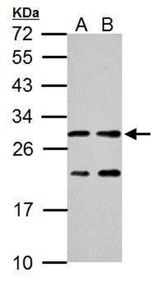 ERAB Antibody in Western Blot (WB)