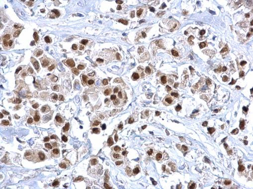 FOXA1 Antibody in Immunohistochemistry (Paraffin) (IHC (P))