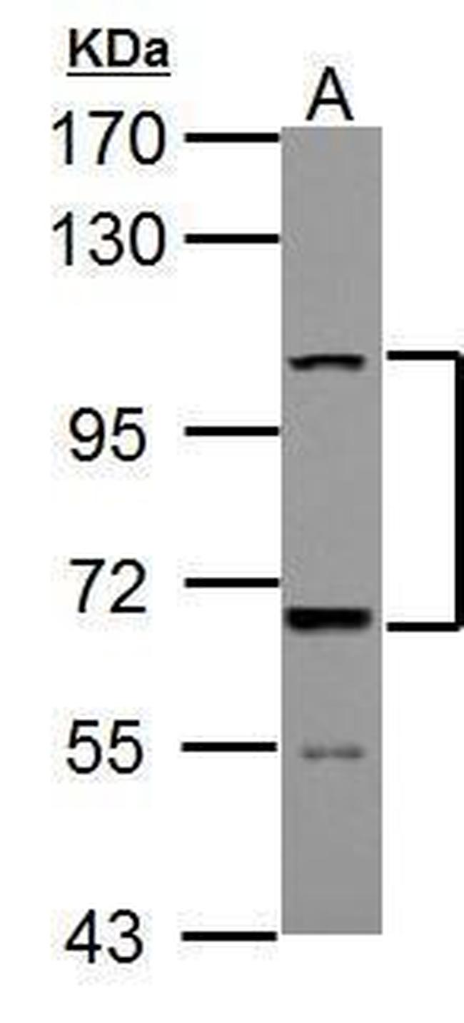 ADAMTS5 Antibody in Western Blot (WB)