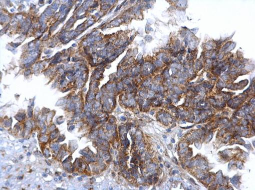 CCR3 Antibody in Immunohistochemistry (Paraffin) (IHC (P))