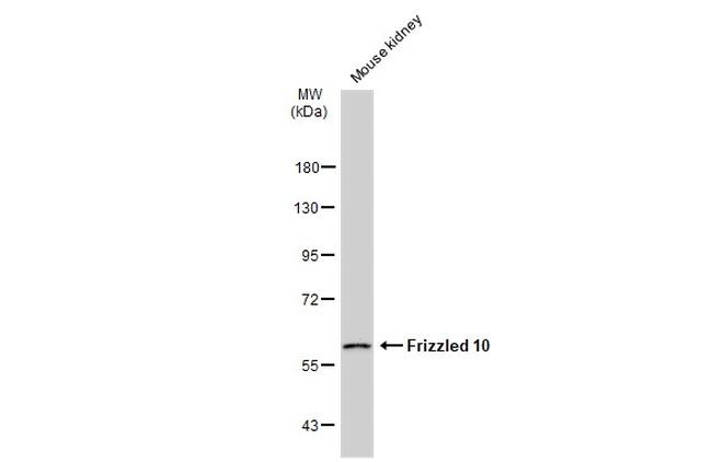 FZD10 Antibody in Western Blot (WB)