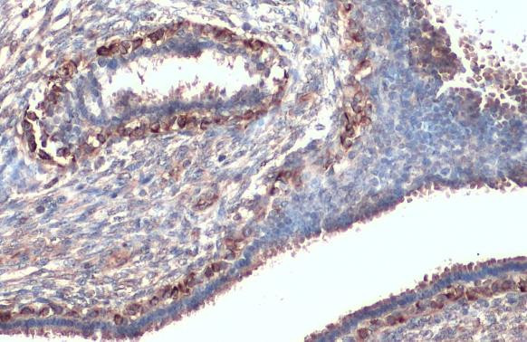 CXCR1 Antibody in Immunohistochemistry (Paraffin) (IHC (P))