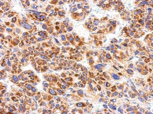 CXCR1 Antibody in Immunohistochemistry (Paraffin) (IHC (P))