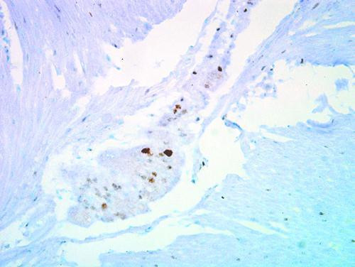 p27 Kip1 Antibody in Immunohistochemistry (Paraffin) (IHC (P))