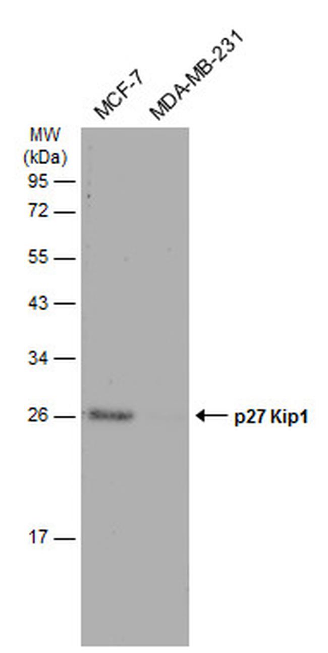 p27 Kip1 Antibody in Western Blot (WB)