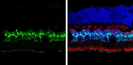 p27 Kip1 Antibody in Immunohistochemistry (Frozen) (IHC (F))