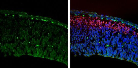 IGFBP3 Antibody in Immunohistochemistry (Frozen) (IHC (F))