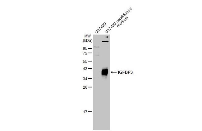 IGFBP3 Antibody in Western Blot (WB)